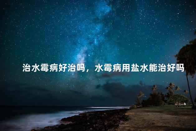 治水霉病好治吗，水霉病用盐水能治好吗